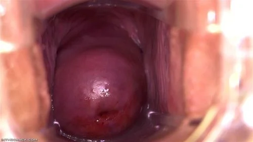 Tess's Tube ft. Tess Lyndon: Closeup, Speculum & Cervix Porn
