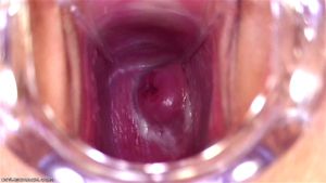 Vaginal Speculums thumbnail