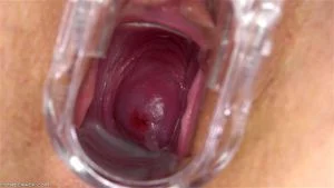 Pussy Close Up, Gape Vagina, Cervix  thumbnail