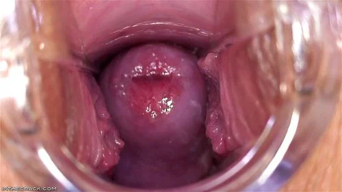 cervix, speculum, fetish, closeup