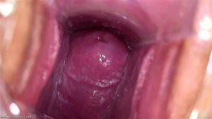 CERVIX thumbnail