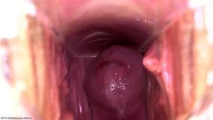 Vaginal Speculums thumbnail