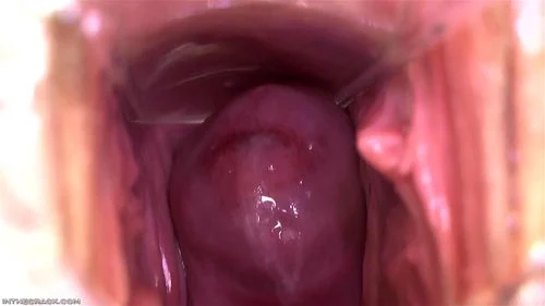 close up, cervix, fetish, speculum