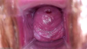 Pussy Close Up, Gape Vagina, Cervix  thumbnail