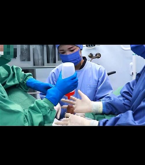 surgical nurse handjob: Big Ass, Brunette & Xhamster Porn - SpankBang