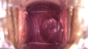 Pussy Close Up, Gape Vagina, Cervix  thumbnail