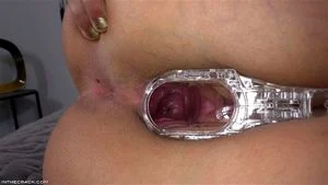 Speculum thumbnail