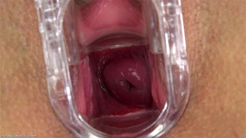 cervix, fetish, close up, speculum