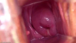 Vaginal Speculums thumbnail