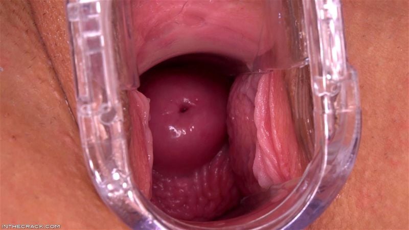 Good Cervix Good Cervix