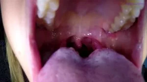 Mouth/Tongue thumbnail