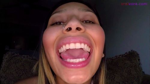 mouth kink