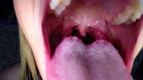 mouth kink