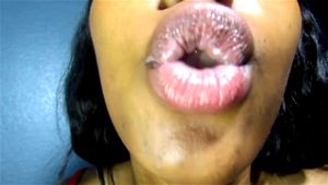 Mouth thumbnail