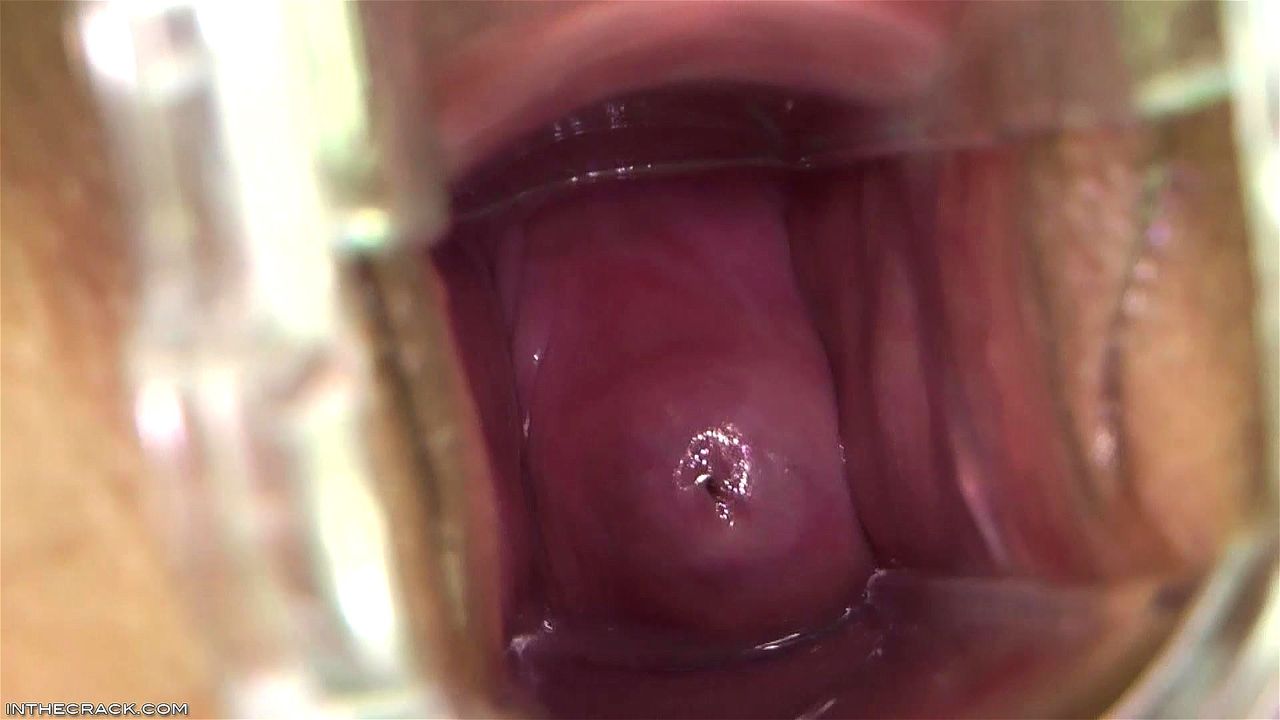 jap junior bondage cervix Watch Cunt Action - Cervix, Closeup, Speculum Porn - SpankBang