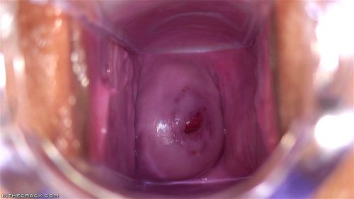 Cervix porn video – Billiards Anyone