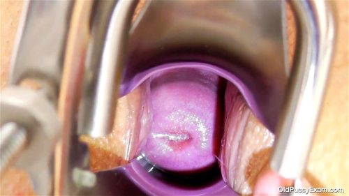 Cervix porn video – Karen Gyno Exam