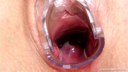 Cervix porn video – Nurse Venus