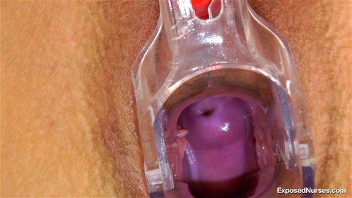 Cervix porn video – Nurse Lucy