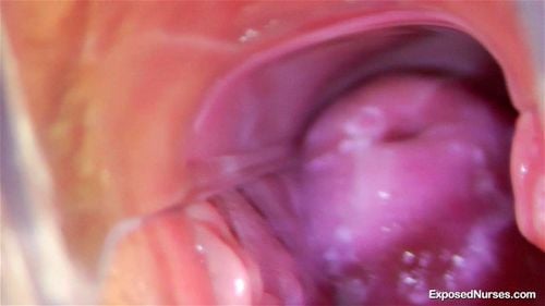 Cervix porn video – Nurse Kiera
