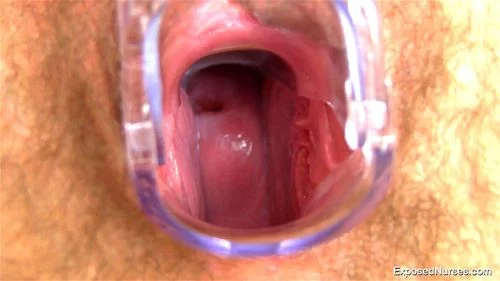 cervix, speculum, babe, hairy pussy