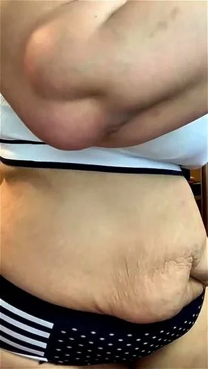 Best Stretchmarks thumbnail