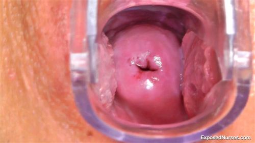 Cervix porn video – Nurse Terry