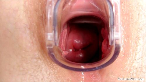 Cervix porn video – Electra Angels Gyno Exam
