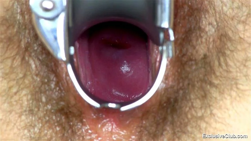Promesita Gyno Exam Promesita Gyno Exam