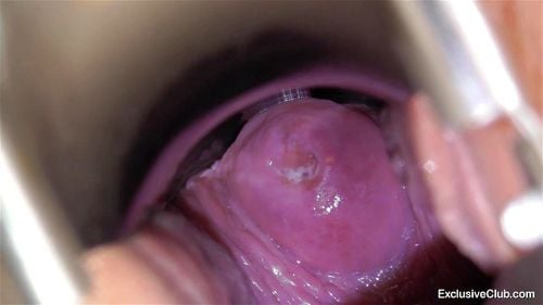 Cervix porn video – Tarya King Gyno