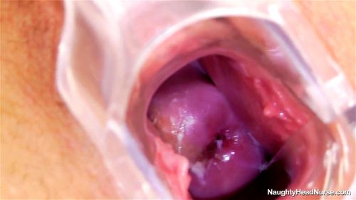 Cervix porn video – Nurse Stepanka