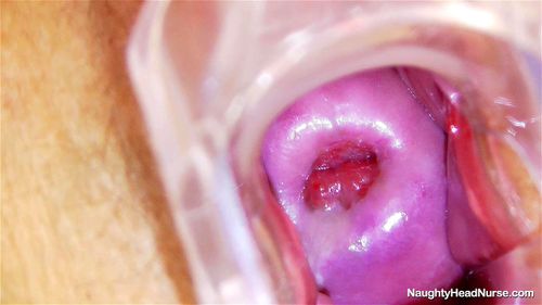 Cervix porn video – Nurse Tonca