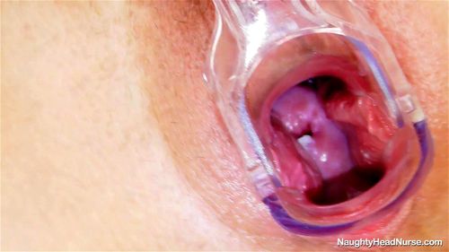 Cervix porn video – Nurse Radana
