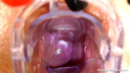 Cervix porn video – Nurse Ruby