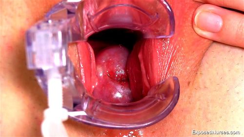 Cervix porn video – Nurse Adela