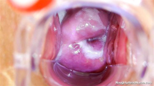Cervix porn video – Nurse Liba
