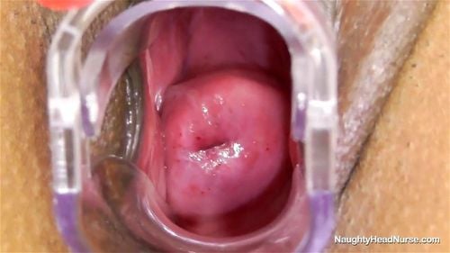 Cervix porn video – Nurse Isabella