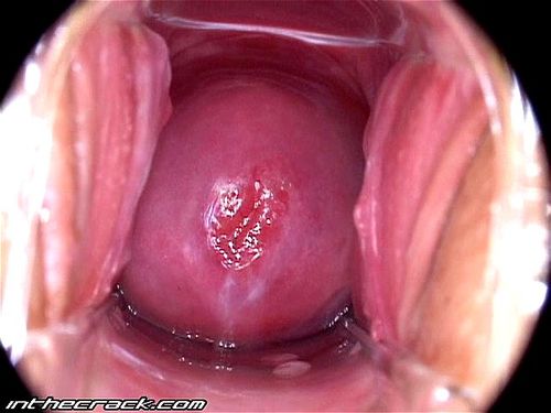 Cervix porn video – Eye to Eye