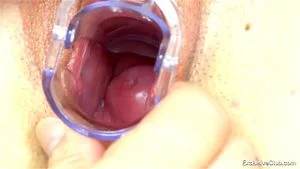 Medical thumbnail