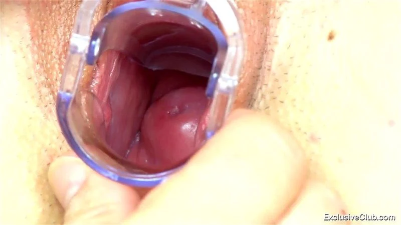 Maya Gyno Exam Maya Gyno Exam