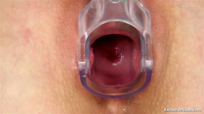 Uma Zex Gyno Exam Uma Zex Gyno Exam