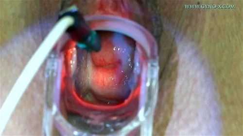 Ginger Gyno Exam: Onlyfans, Speculum & Cervix Porn - SpankBang