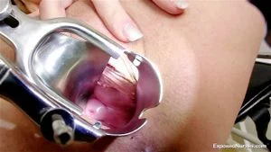 Speculum thumbnail