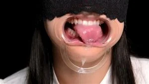 gape mouth dentalgag thumbnail