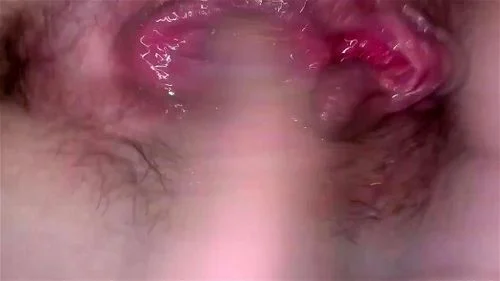 Clitora vulva pussy thumbnail