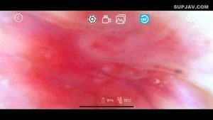 Watch from 1:00:49
