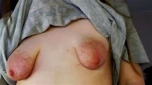 Nips thumbnail