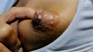 Breast thumbnail