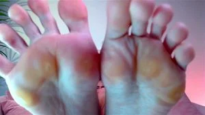 Calloused feet thumbnail