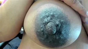 Areolas thumbnail